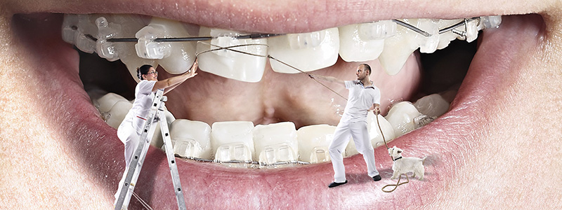 Sık Sorulan Ortodonti Soruları